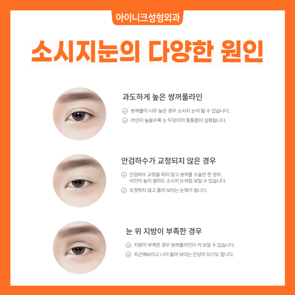 소시지눈해결방법으로 알아보는 확실한 재수술 관련 이미지 2
