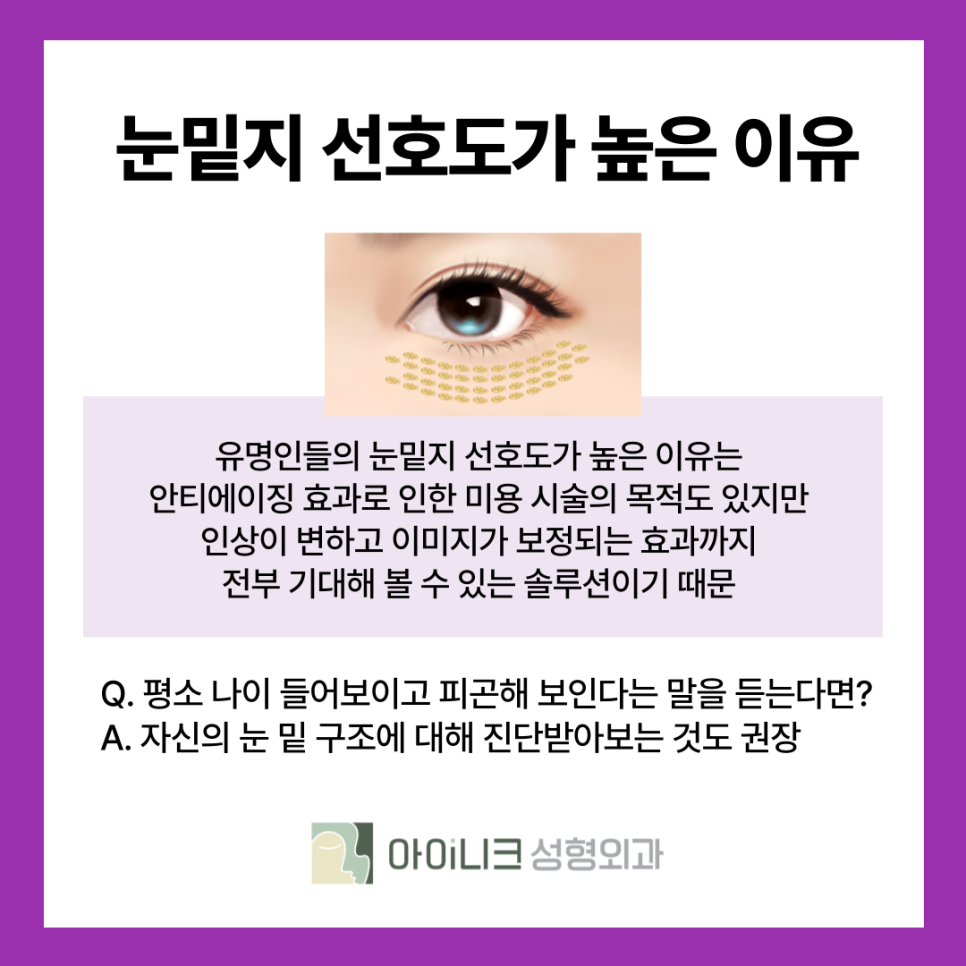 연예인들도 많이 하는 서울 눈밑지방재배치의 기대 효과는? 관련 이미지 12