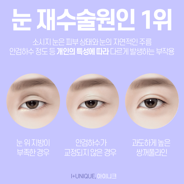 쌍꺼풀재수술병원을 고를 때엔 경험과 노하우가 중요합니다. 관련 이미지 3