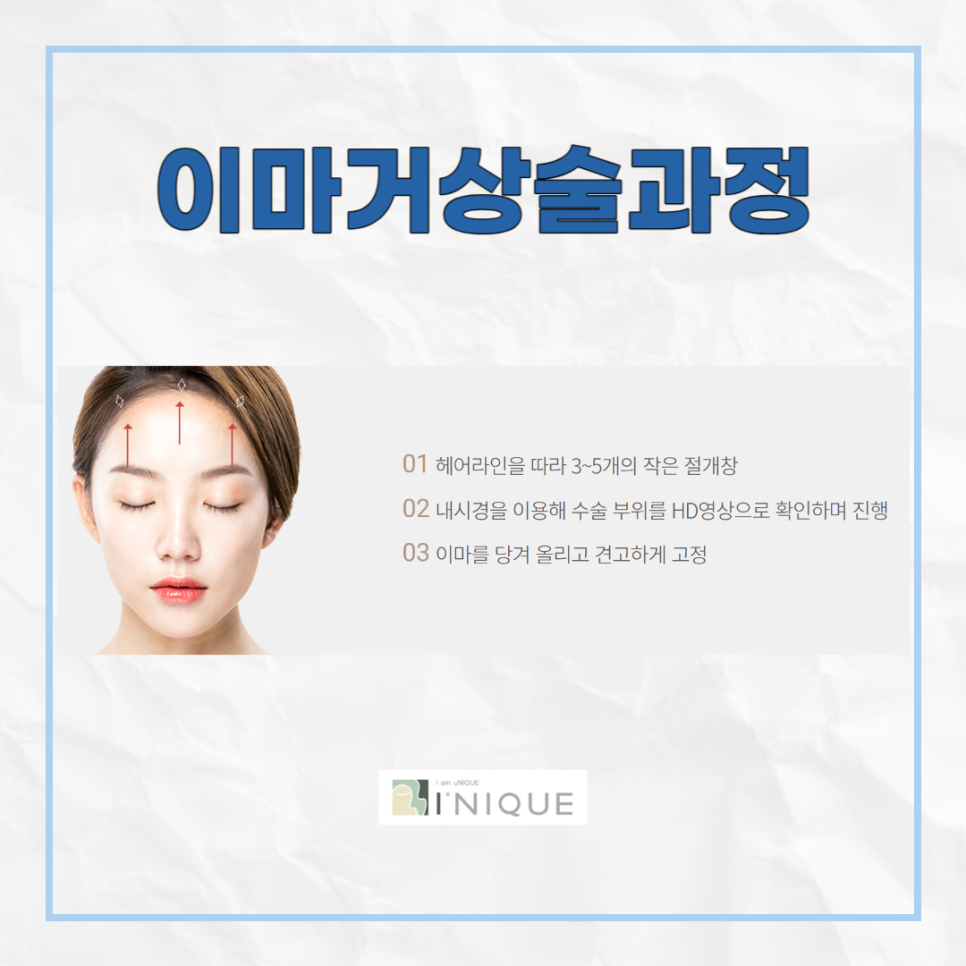 눈꺼풀처짐수술비용, 합리적인 선택을 하려면? 관련 이미지 5