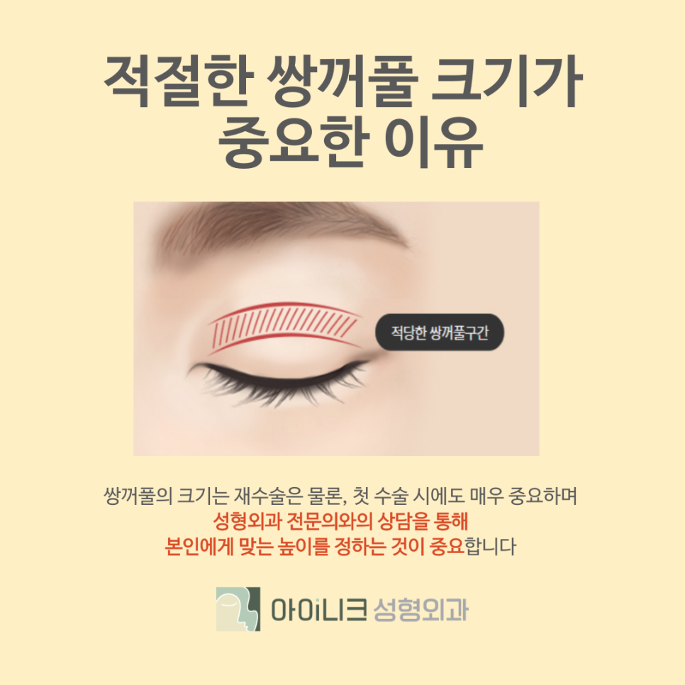 Gangnam Eye Revision Surgery Hospital: If You Want to Restore a Failed Double Eyelid image 4