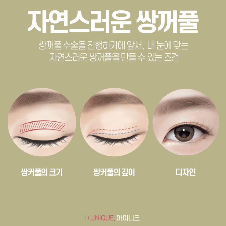 쌍커풀잘하는곳 찾고 있다면 이건 확인해 봐야죠! 관련 이미지 2