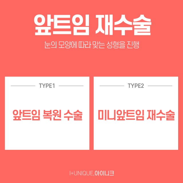 앞트임재수술로 자연스러운 눈 만들자! 관련 이미지 2