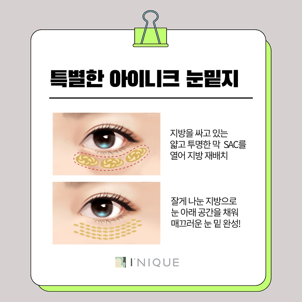 Recommended Seoul Encore Laser! What Are the Conditions for Looking Young? image 5