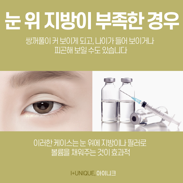 쌍수재수술병원을 고를 땐 의사의 실력이 중요합니다 관련 이미지 5