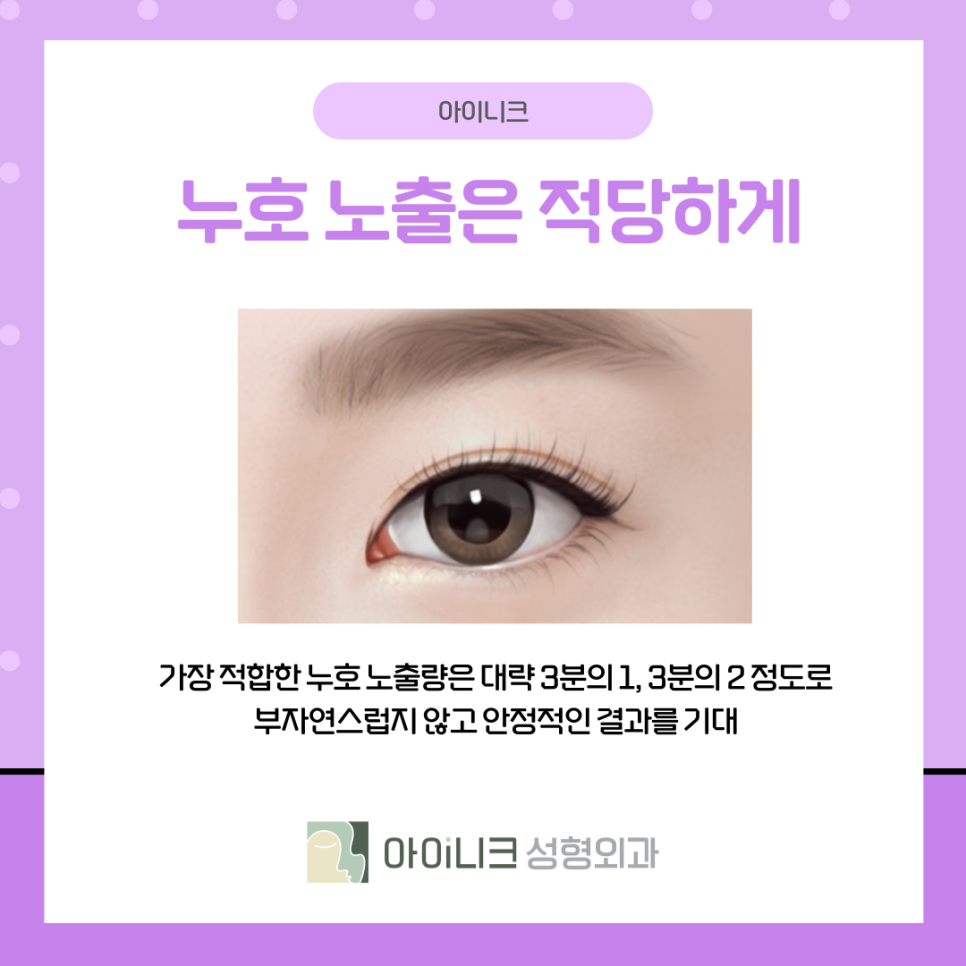 앞트임눈매교정 과하지 않고 자연스럽게 관련 이미지 9