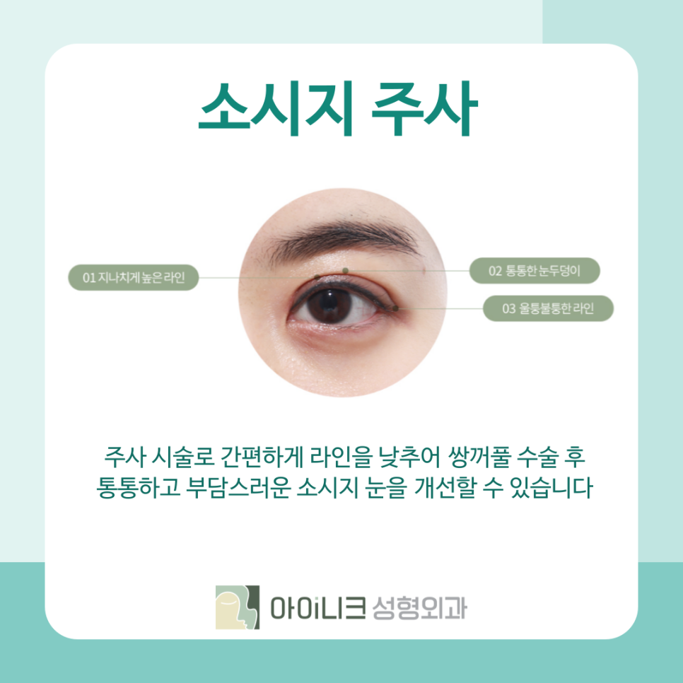 청담역 눈재수술 병원 고민되시나요? 관련 이미지 7