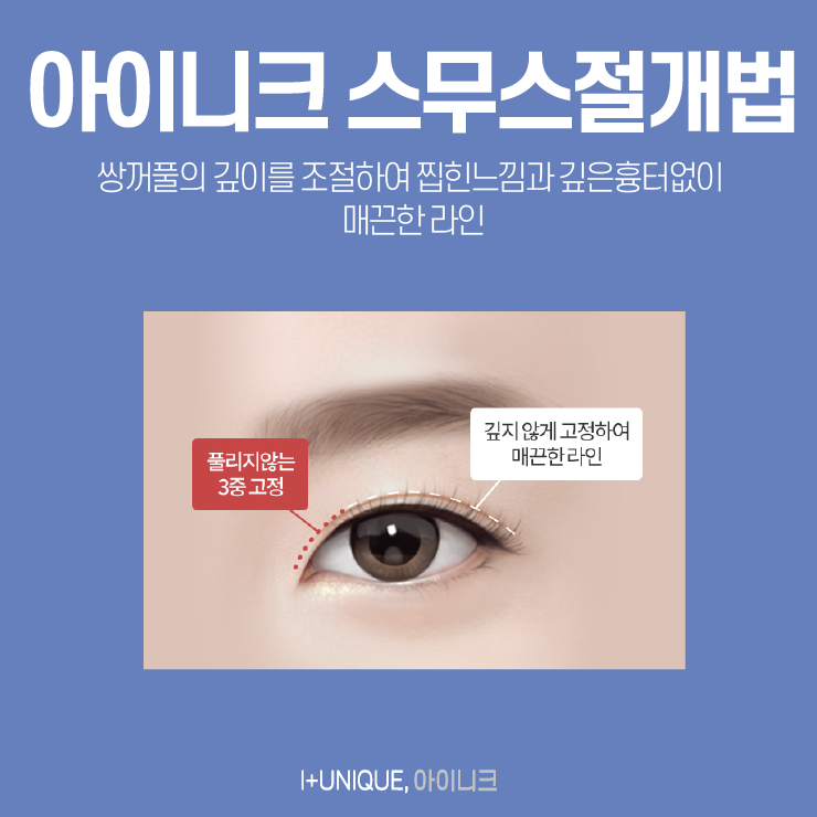 쌍커풀수술병원 첫 수술이니까 신중하게 아이니크성형외과에서 관련 이미지 3
