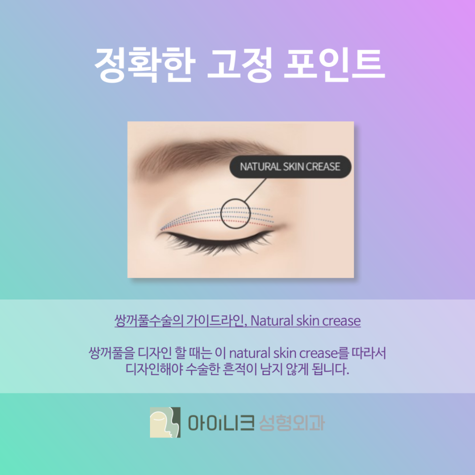 쌍수흉터 유형과 개선하는 방법 관련 이미지 6