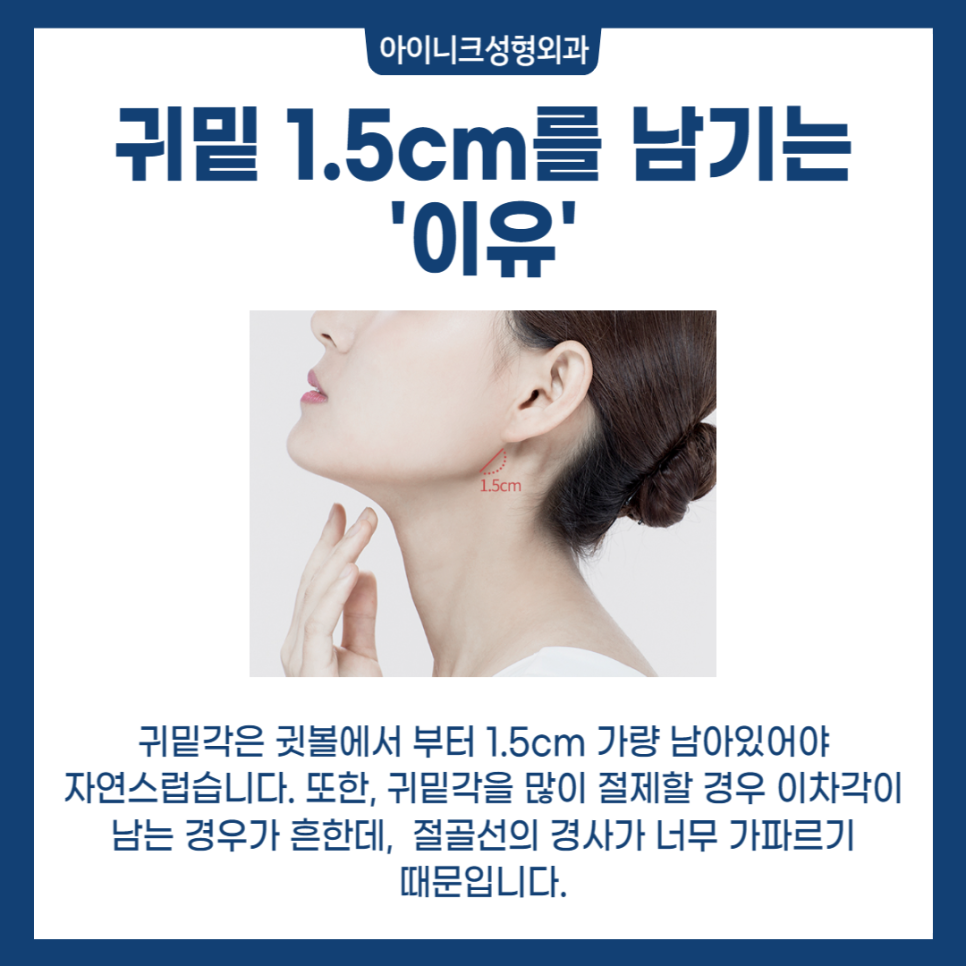 자연스러운 V라인 사각턱성형 관련 이미지 5
