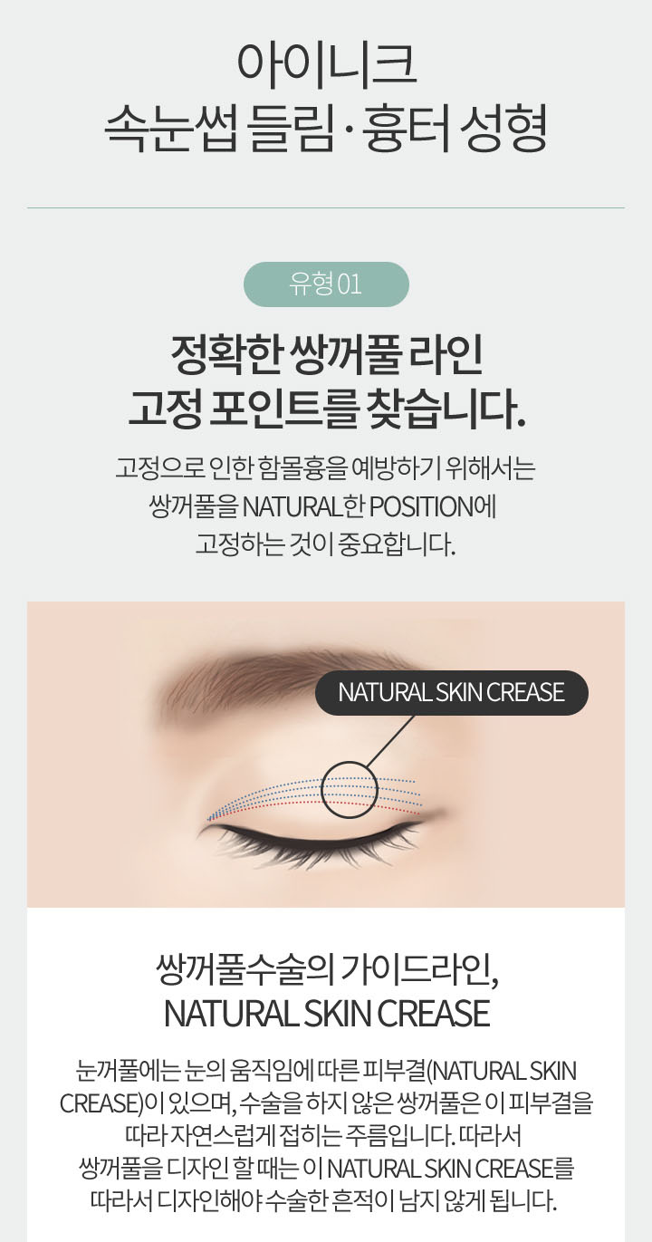 속눈썹들림 더 이상 고민하지 마세요! 관련 이미지 3