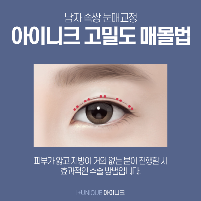 남자쌍수가격이 고민된다면? 관련 이미지 3