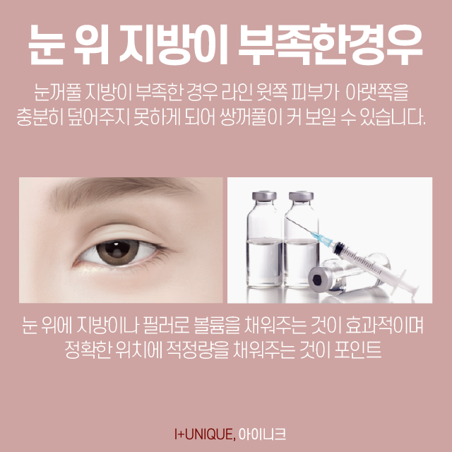 강남쌍꺼풀재수술 알아보고 있다면, 합리적인 선택을! 관련 이미지 5