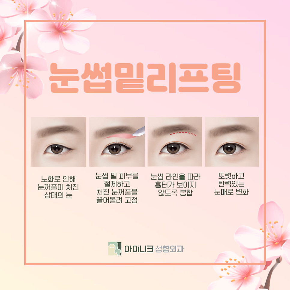 Middle-Aged Eye Reoperation, Different from Younger People! image 4