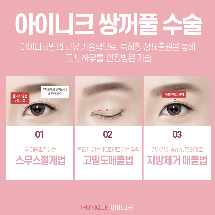 눈쌍커풀수술, 처음부터예뻤던 것처럼 아이니크성형외과에서 관련 이미지 3