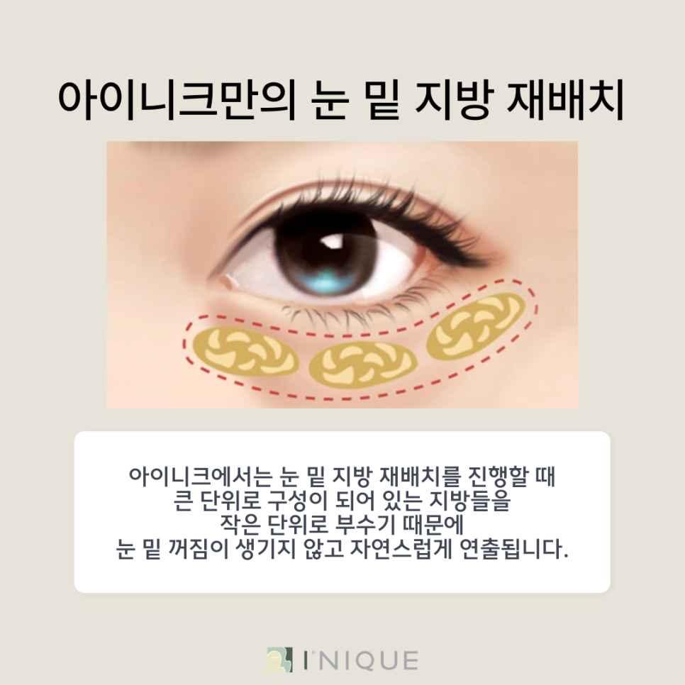 When You're Looking for a Natural Under-Eye Correction image 4