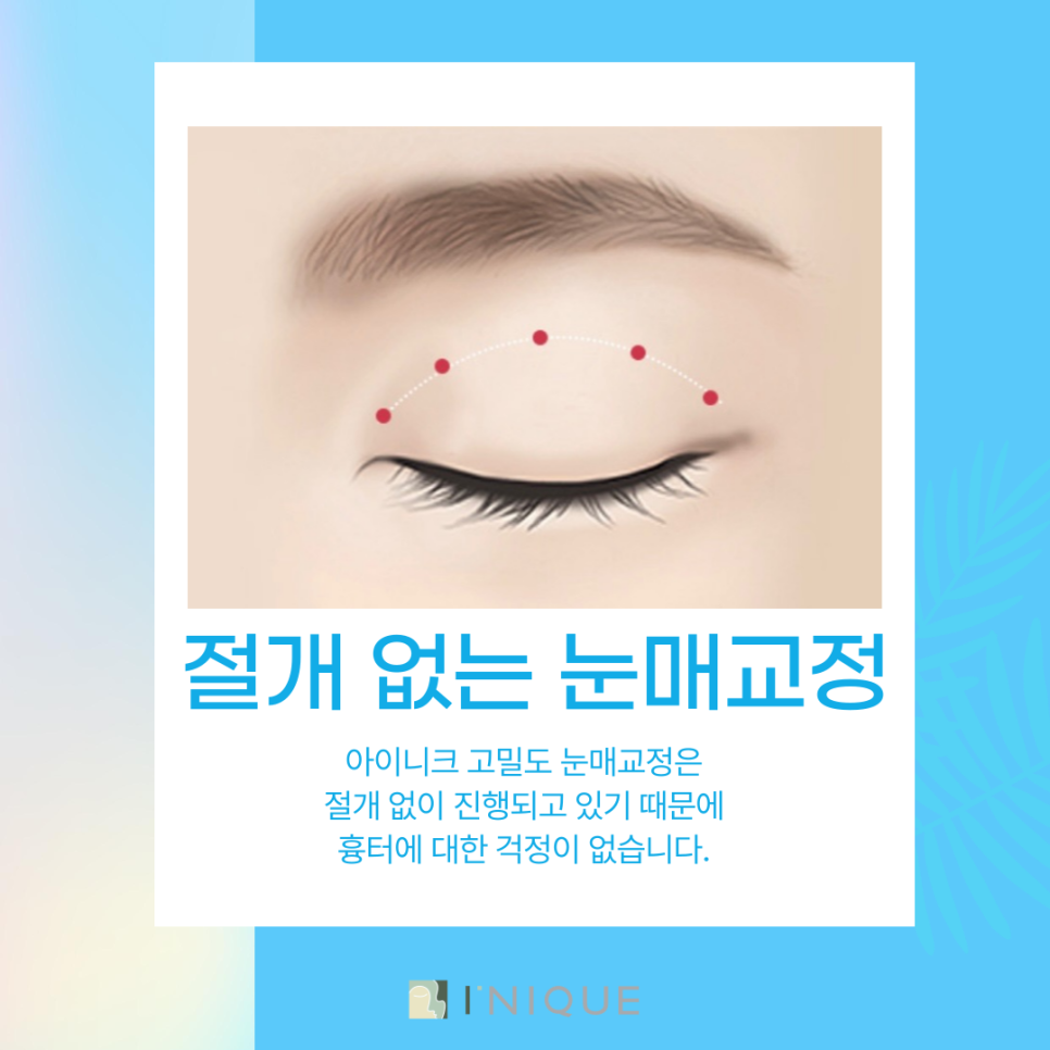 Eyelid Correction Near Gangnam Station at Inique image 5