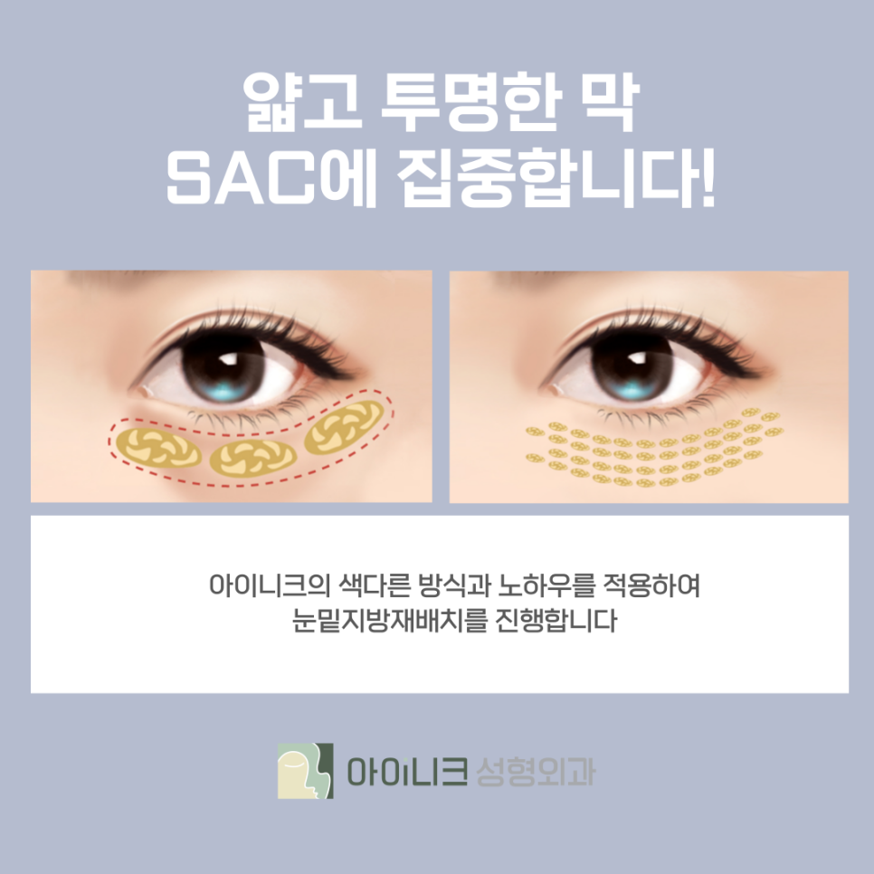 When Is Eye Fat Removal Necessary? image 11