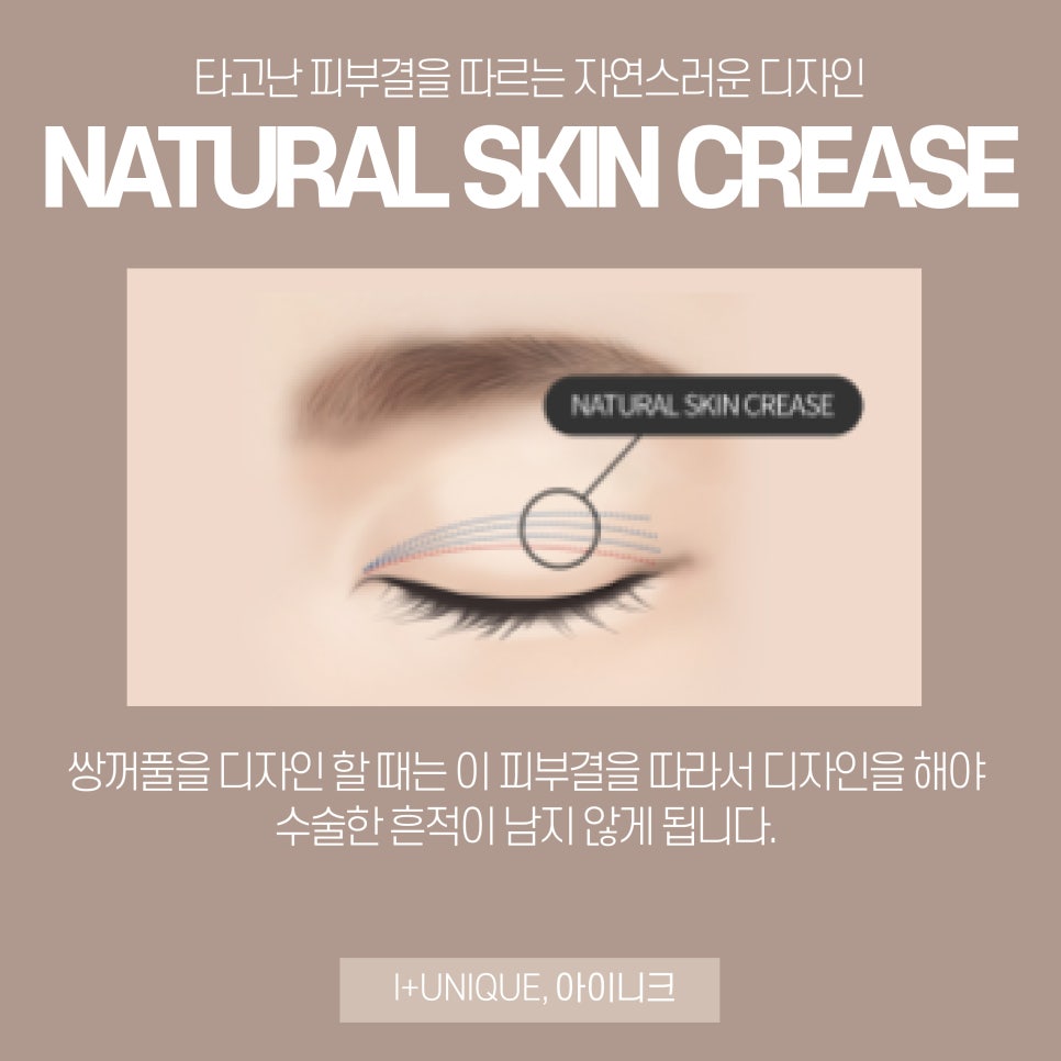 쌍꺼풀수술병원 믿을 수 있는 선택, 아이니크성형외과 관련 이미지 5