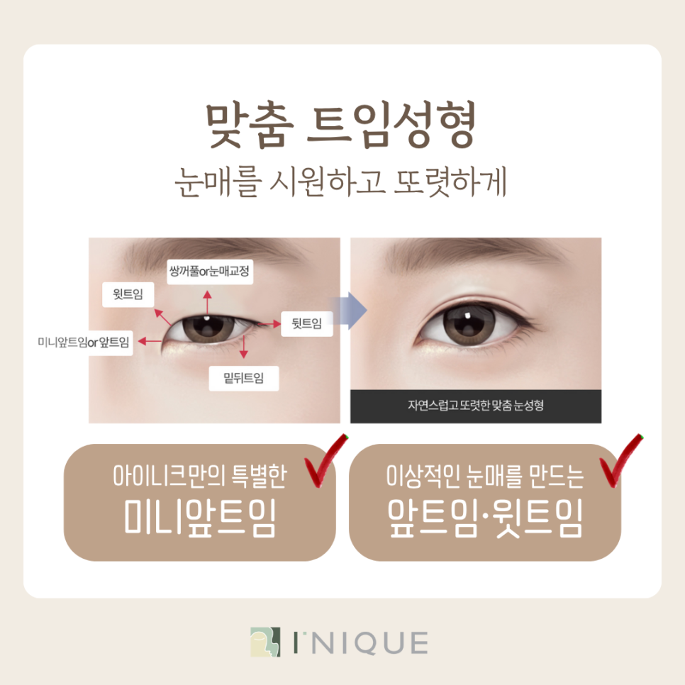 Small Eye Surgery: Turning a Complex into Confidence! image 8