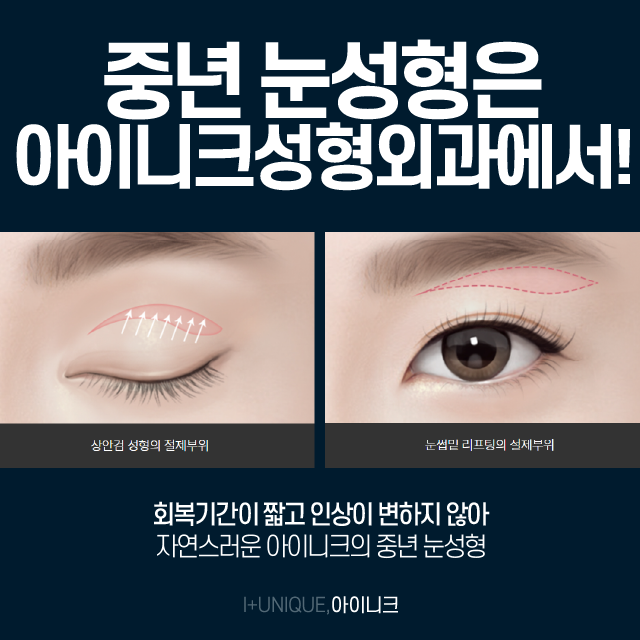 중년눈매교정 자연스러운 아름다움이 가장 좋습니다. 관련 이미지 5