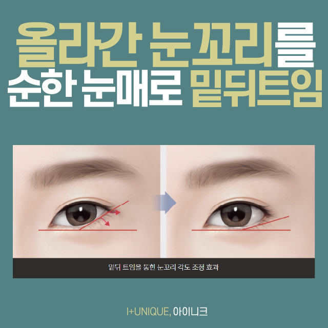 부작용 걱정없는 아이니크의 안전한 뒤트임 관련 이미지 4