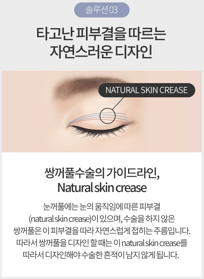 쌍수두께 병원 선택이 중요합니다! 관련 이미지 6