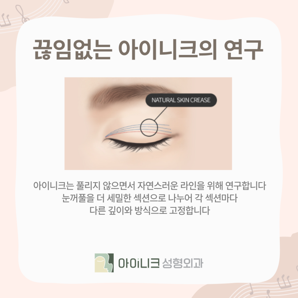 아이들 눈매 원하는 사람~ 연예인 쌍꺼풀의 비밀! 관련 이미지 6