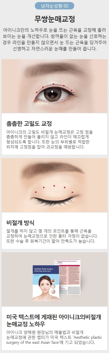 비절개눈매교정술 주의할 건 없을까? 관련 이미지 5
