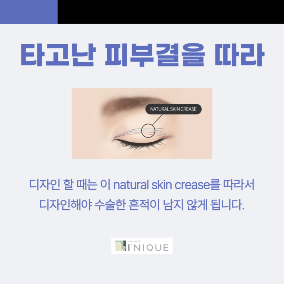 압구정 쌍수잘하는곳 아이니크 관련 이미지 5