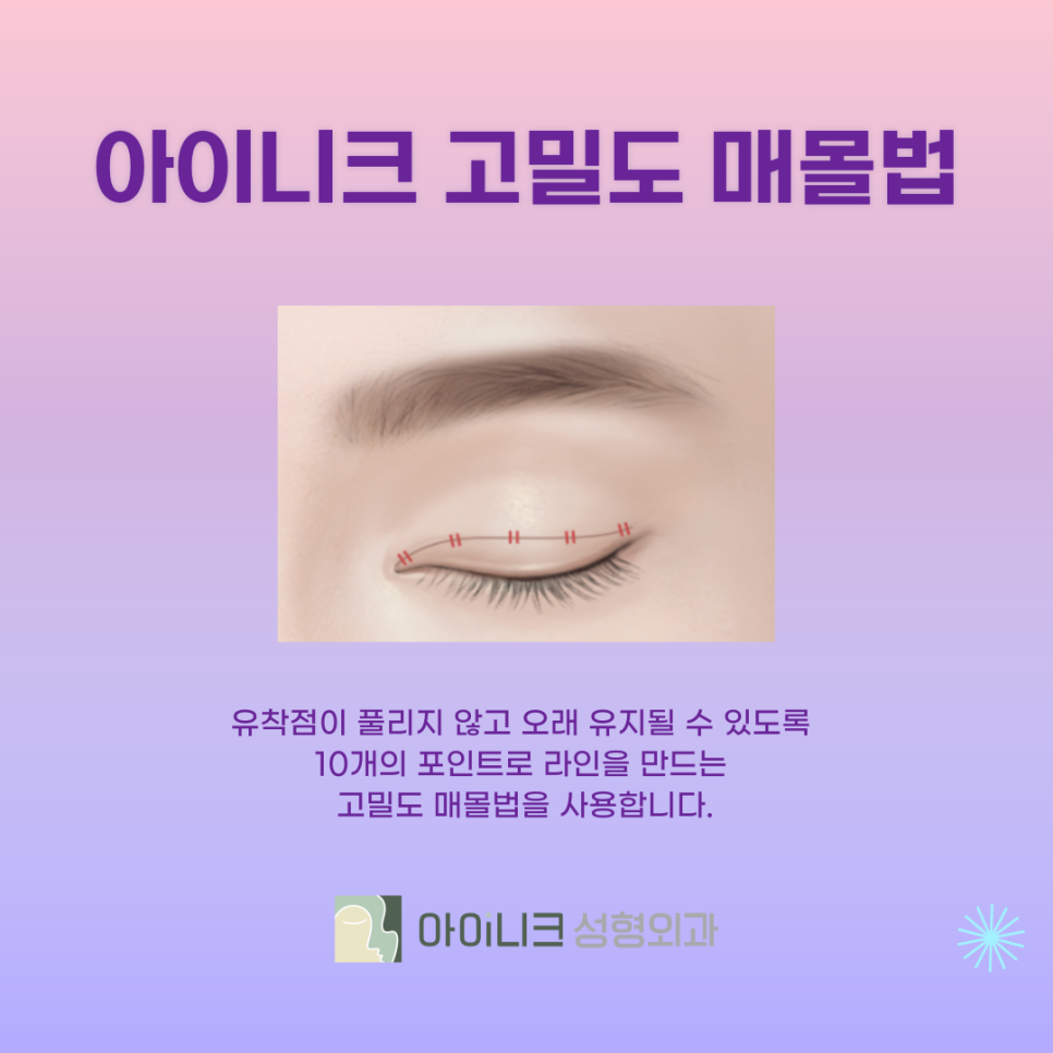 How Can You Make a Regret-Free Choice for Double Eyelid Surgery in Apgujeong? image 6
