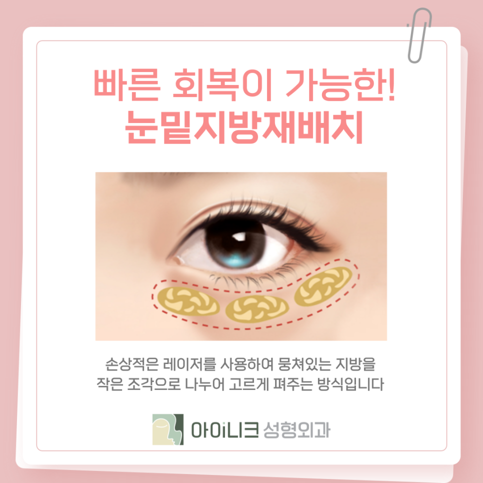 다크서클제거 손상적은 개선방법 관련 이미지 10