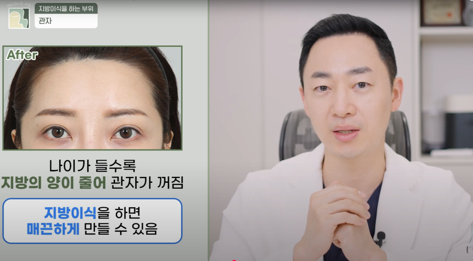 Look Younger with Gangnam Encore Under-Eye Fat Grafting! image 8