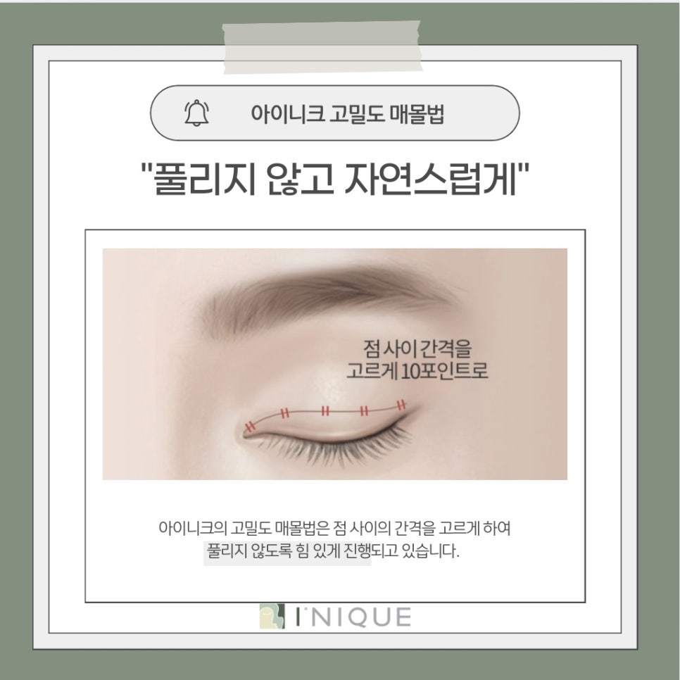 남자쌍수잘하는곳 찾을 때 관련 이미지 3