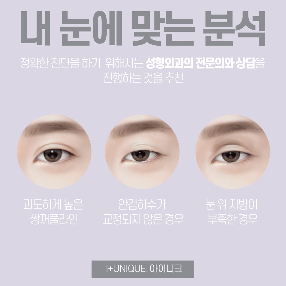 속상한 쌍꺼풀라인낮추기 아이니크성형외과에서 해결하자 관련 이미지 2