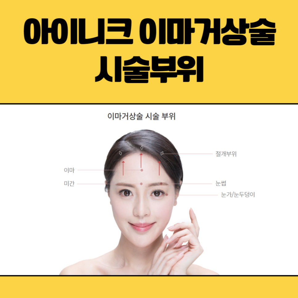 이마거상술잘하는곳 뭐가 다를까? 관련 이미지 4