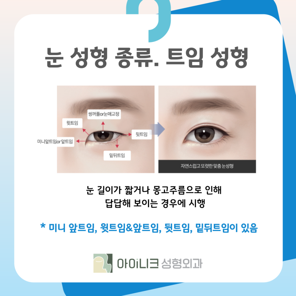 강남성형외과유명한곳 눈 성형 종류가 궁금해요 관련 이미지 9