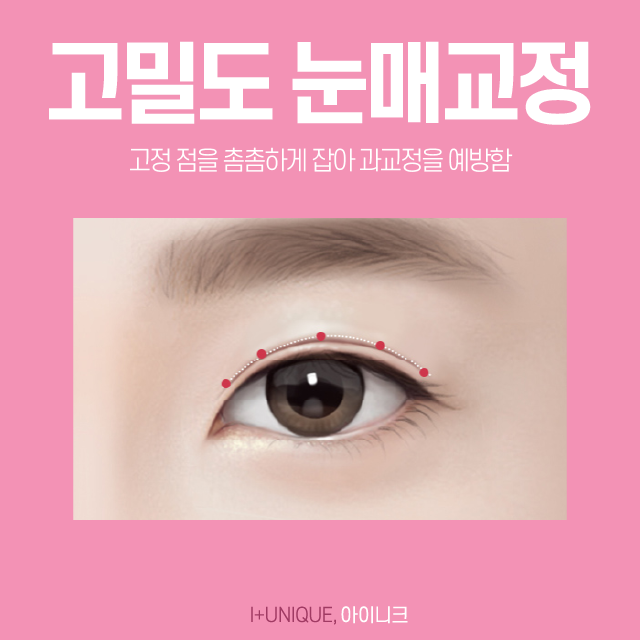 졸린 눈이 고민이라면 졸린눈성형인 눈매교정술로 또렷한 눈으로 거듭나기! 관련 이미지 5