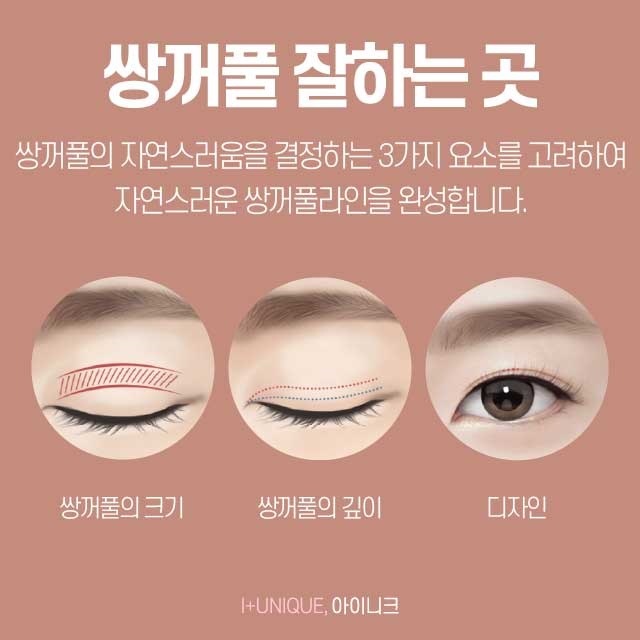 강남쌍꺼풀수술 믿을만 한 곳으로 선택하자! 관련 이미지 2