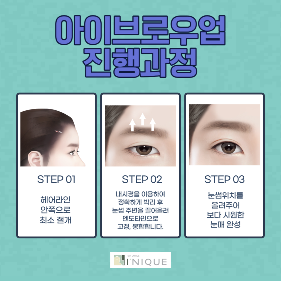 눈썹올림술로 주름 고민 말끔 해결! 관련 이미지 2