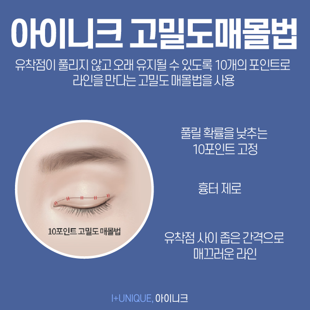 내 눈에 맞는 쌍꺼풀수술종류는 따로있다 아이니크성형외과에서 알아보자 관련 이미지 5