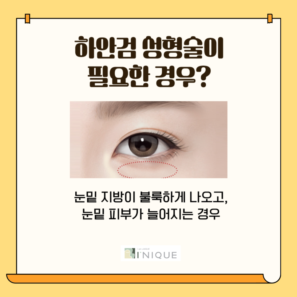 하안검잘하는병원 효도선물로 찰떡 관련 이미지 3