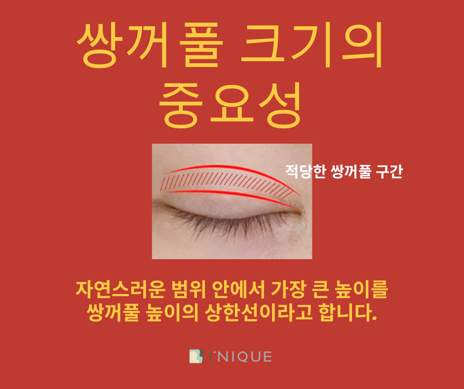 쌍꺼풀잘하는곳 찾는다면? 관련 이미지 5