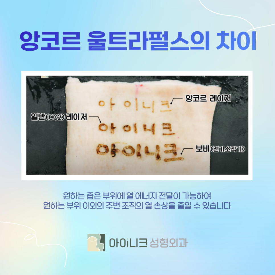 눈밑지방레이저수술 만족스러운 결과를 얻으려면 관련 이미지 6