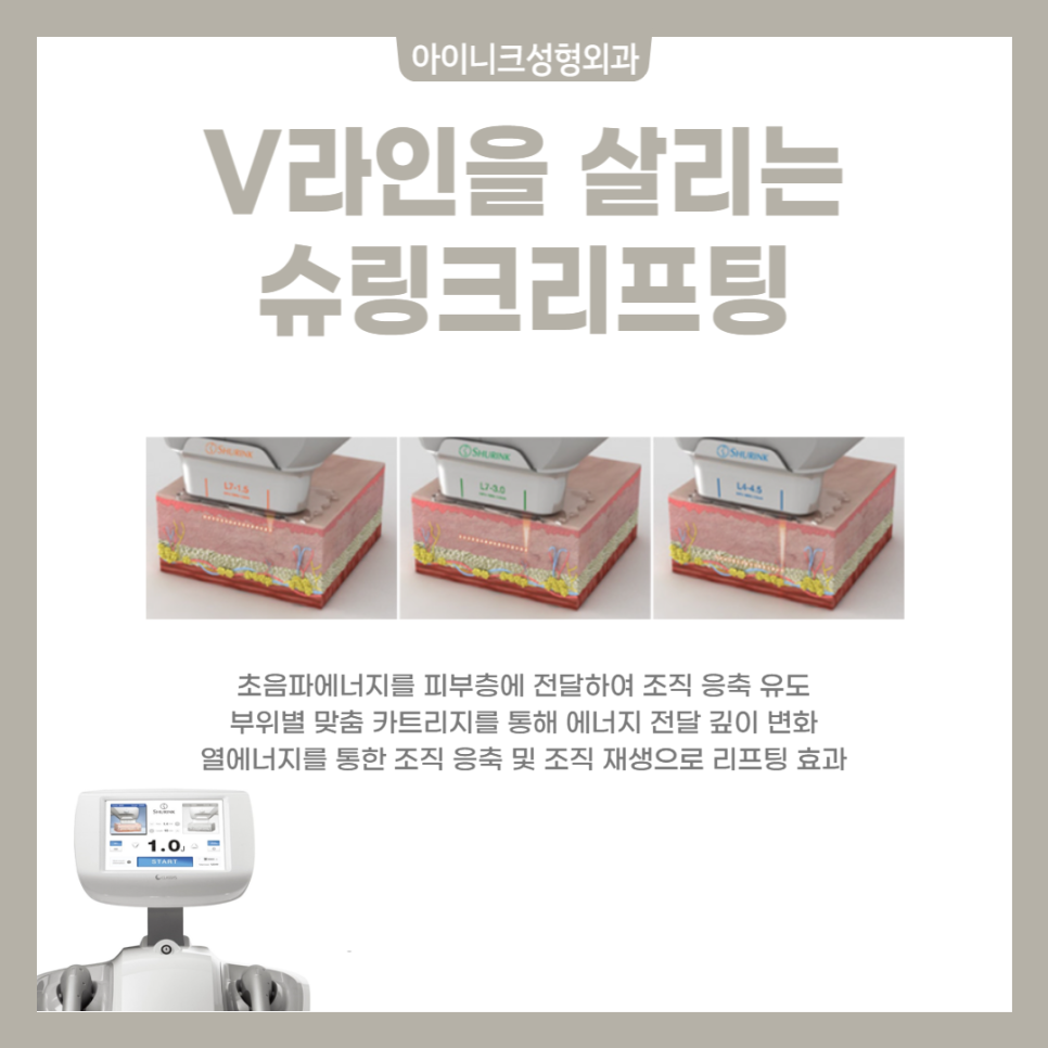 쁘띠성형종류 통증없이 잡는 얼굴라인 관련 이미지 6