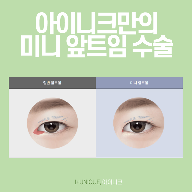 앞, 뒤트임재수술은 아이니크 성형외과에서! 관련 이미지 4