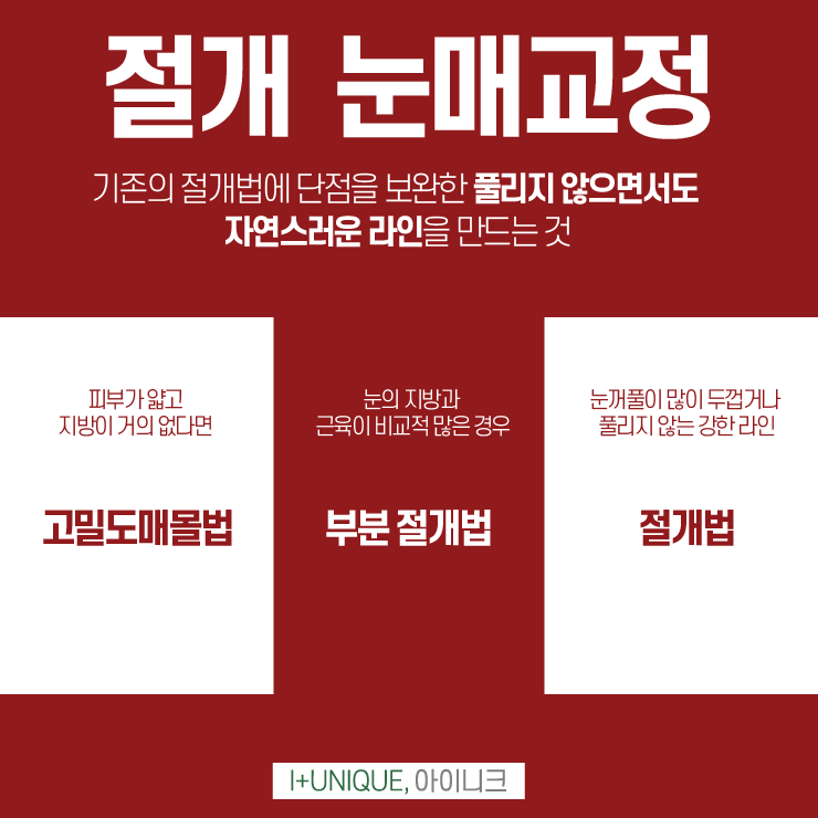 남자눈매교정병원은 더욱 신중해야한다 아이니크성형외과 관련 이미지 5