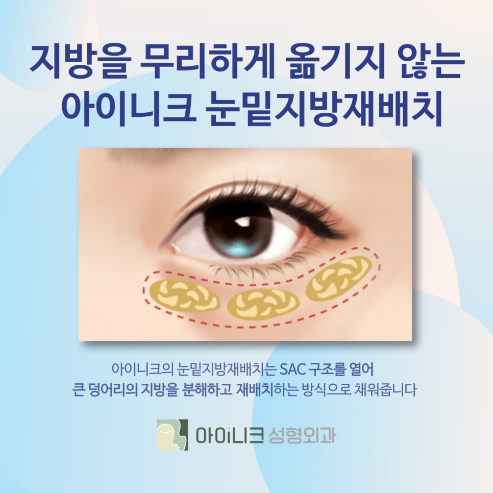 압구정눈밑지방재배치 SAC에 집중하는 방식 관련 이미지 5