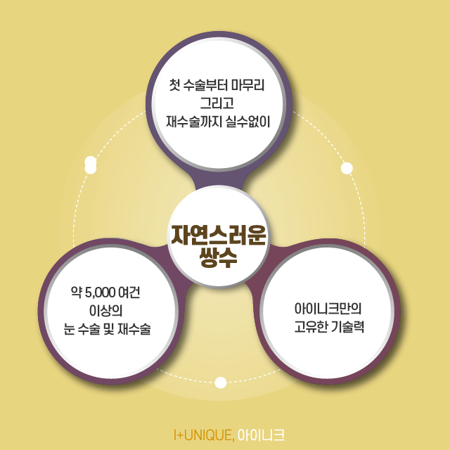 내 눈에 잘 맞는 자연스러운쌍수를 위해 알아야 할 점! 관련 이미지 5