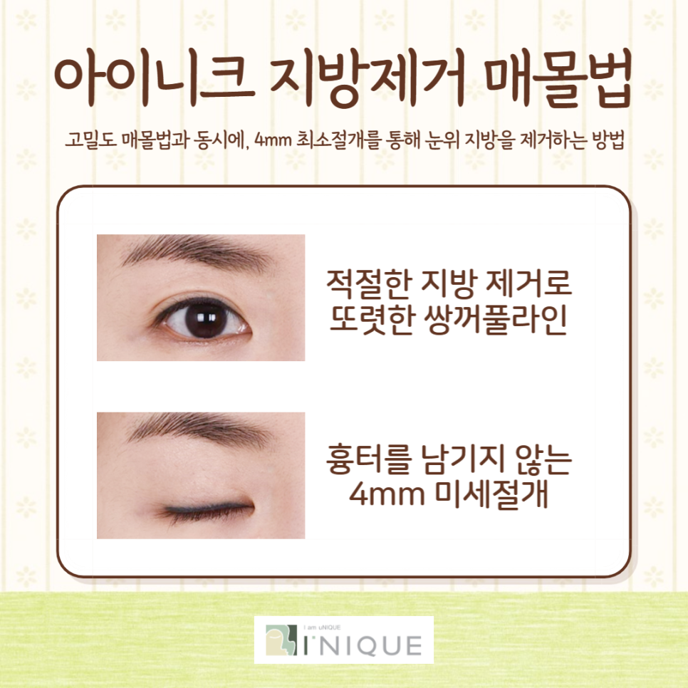 Are You Looking for a Specialized Double Eyelid Plastic Surgery Clinic? image 6